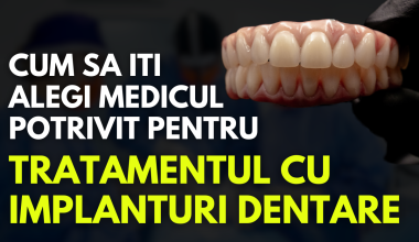 Ai nevoie de implanturi dentare dar inca nu ai gasit medicul potrivit